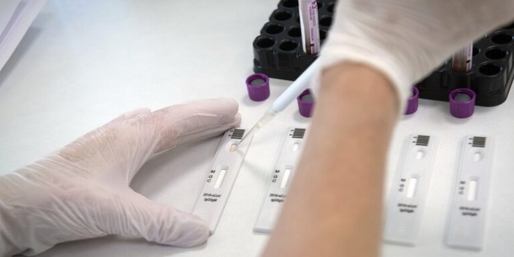 الصحة العالمية تقيم إمكانية تحول كوفيد-19 إلى “عدوى موسمية “