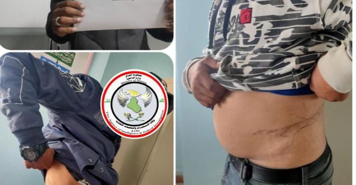 الاستخبارات تقبض على أكبرعصابة تتاجر بالأعضاء البشرية