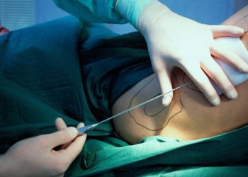الكشف عن عدد مراكز التجميل غير المرخصة في العراق و سبب انتشارها