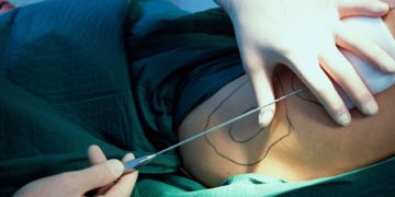 الكشف عن عدد مراكز التجميل غير المرخصة في العراق و سبب انتشارها