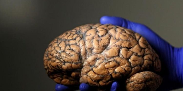 يقترب العلماء من تغيير ذاكرة الإنسان… فهل يجب أن يفعلوا ذلك؟