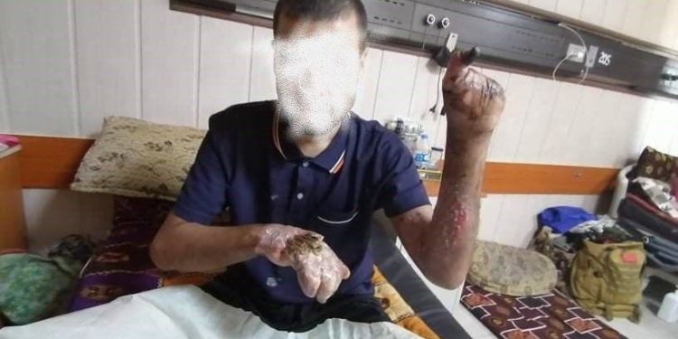 بالفيديو – فضيحة تعذيب جديدة في معتقلات الداخلية + صور
