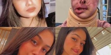 مأساة تهز العراق ,, شاب يشوه جسد فتاة بـ”التيزاب” لرفضها الزواج منه ‎#انقذوا_الاميرة_مريم