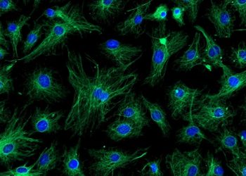 تحديد (خلايا الزومبي)  تبعث أملا جديدا لعلاج الزهايمر