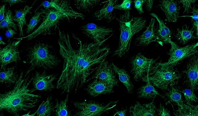 تحديد (خلايا الزومبي)  تبعث أملا جديدا لعلاج الزهايمر