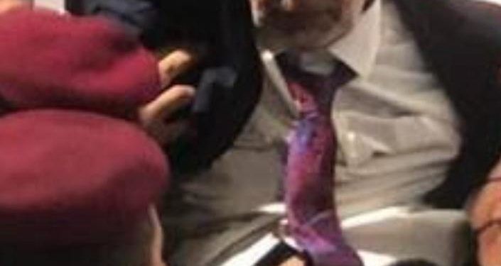 اثار دماء تظهر على قميص رئيس السن