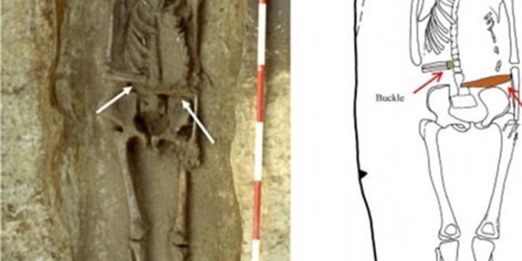 هيكل عظمى لمحارب إيطالى ذراعه المبتورة مستبدلة بسكين