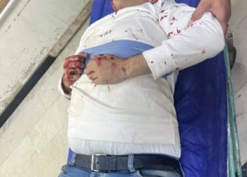 اعتداء بالرصاص الحي على موظف في بلدية النجف + صور