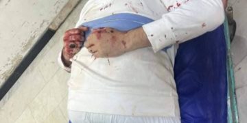 اعتداء بالرصاص الحي على موظف في بلدية النجف + صور