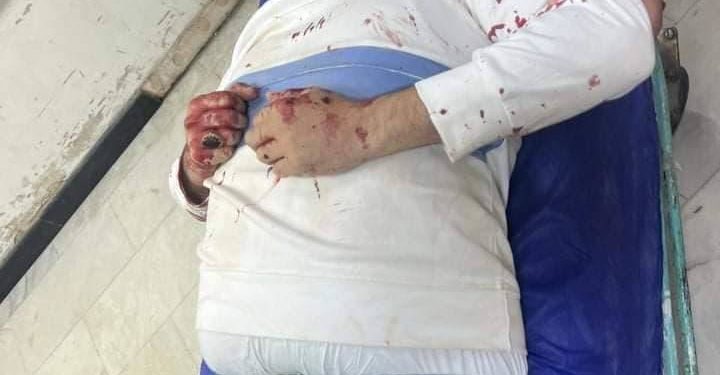 اعتداء بالرصاص الحي على موظف في بلدية النجف + صور