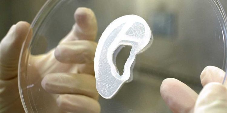 جراح يتمكن من “زرع أذن” أُنشئت من خلايا بشرية باستخدام طابعة ثلاثية الأبعاد