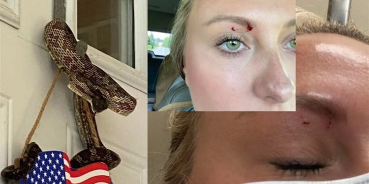 ثعبان يلـــدغ سيدة في عينها .. في حادثة نادرة