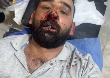 مرصد العراقي للحريات الصحفية يدين تعرض الاعمي علي الذبحاوي الى إعتداء وحشي من قبل مجهولين وهو الان في حالة خطرة