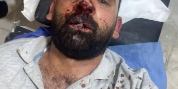 مرصد العراقي للحريات الصحفية يدين تعرض الاعمي علي الذبحاوي الى إعتداء وحشي من قبل مجهولين وهو الان في حالة خطرة