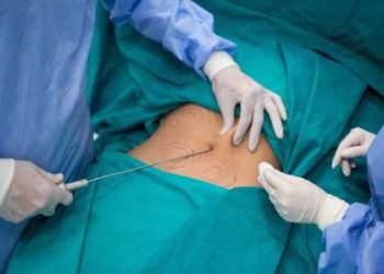 عملية تجميل تنهي حياة شابة في بغداد