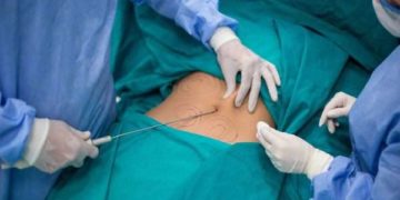 عملية تجميل تنهي حياة شابة في بغداد