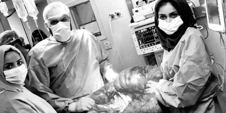  إنقاذ شاب مصاب بتضخم “القولون العملاق” في بغداد + صور