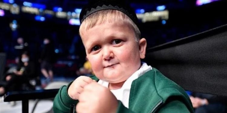  وصول أشهر قزم في العالم إلى أستراليا