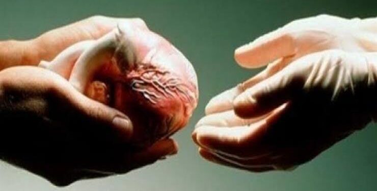 حسم الجدل حول التبرع بالأعضاء بعد الوفاة