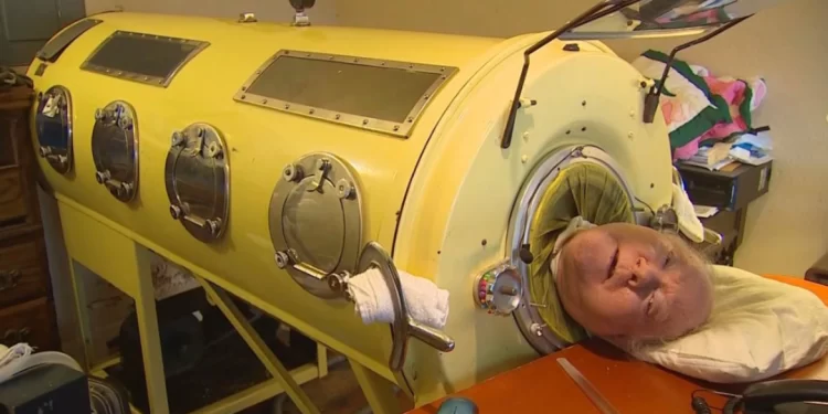 الرجل الذي لم يمنعه شلل الأطفال من ممارسة المحاماة ,, بول ألكسندرعاش في رئة حديدية 70 عاما