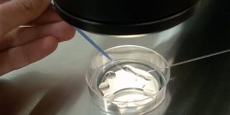 سيدة تحمل من بويضات مجمدة منذ 14 عامًا .. للمرة الأولى في العالم