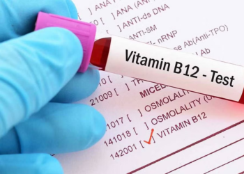 نصائح لتجنب نقص فيتامين (B 12)