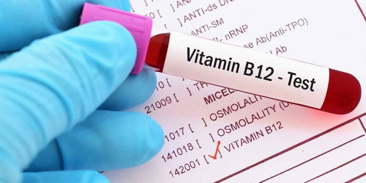 نصائح لتجنب نقص فيتامين (B 12)