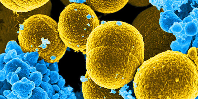 دراسة تكشف السبب الرئيسي الثاني للوفيات في العالم