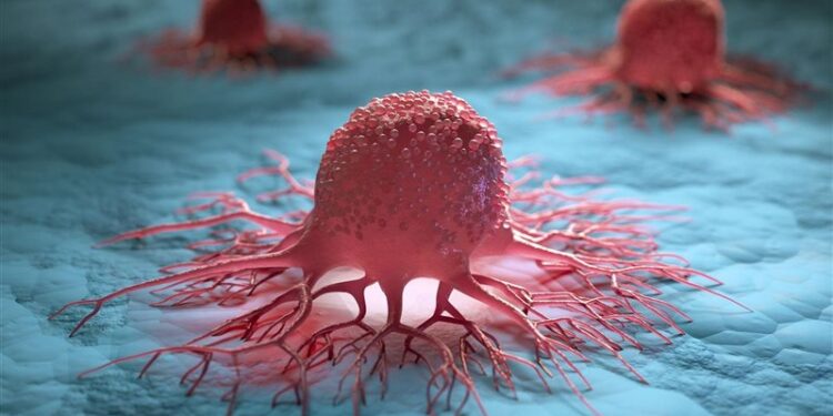 إسبانية تنجو من 12 ورمًا سرطانيًا