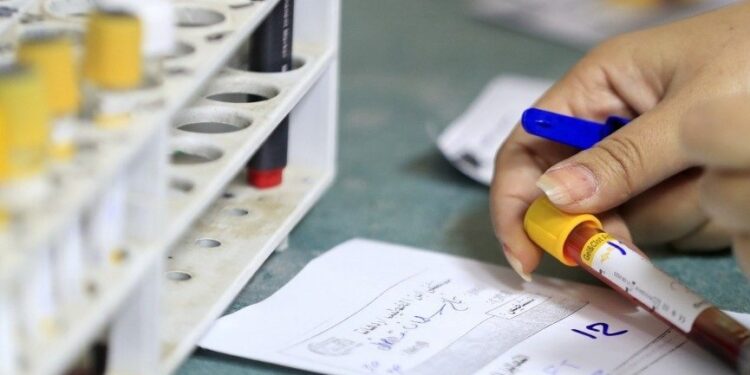 الصحة النيابية تصرح حول (فحص المخدرات) للموظفين والطلبة