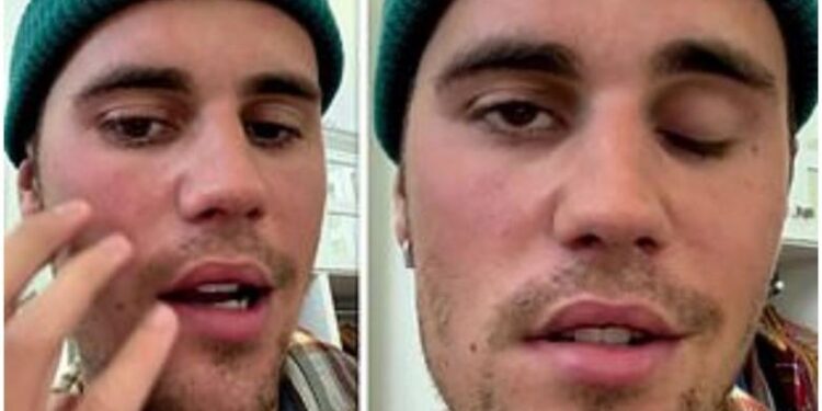 إصابة شاب صيني بشلل في وجهه بســبب “كأس العالم”