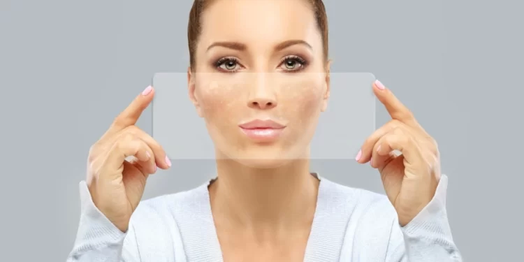 التقشير الكيميائي للجلد.. أنواعه وفوائده وأضراره المحتملة