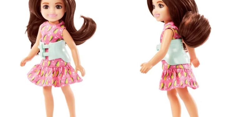 اطلاق أول نسخة من “دمية باربي مصابة بالجنف”