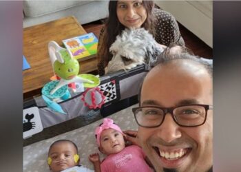 “توأم معجزة” يدخل موسوعة غينيس