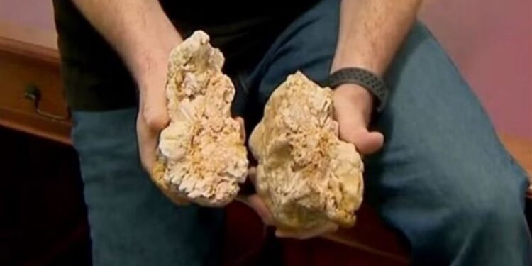 أسترالي محظوظ يعثر على صخرة بمئات آلاف الدولارات