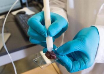 جهاز ذكي يلغــــي الحاجة للجراحة في الكشف عن السرطان