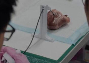 طباعة ثلاثية الأبعاد داخل جسم الإنسان .. (ثورة تكنولوجية)