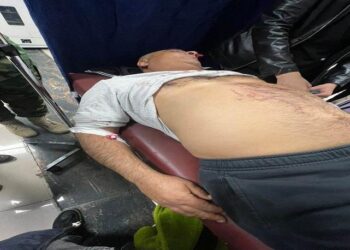 اربيل ..اختطاف محامٍ وتعذيبه بطريقة “وحشية” بسبب قضية طلاق