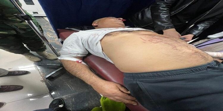 اربيل ..اختطاف محامٍ وتعذيبه بطريقة “وحشية” بسبب قضية طلاق