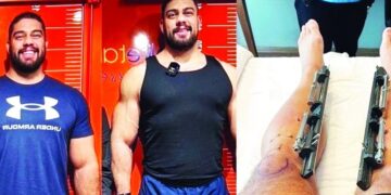 رجل امريكي ينفق 107 آلاف $ ليصبح أطول من زوجته