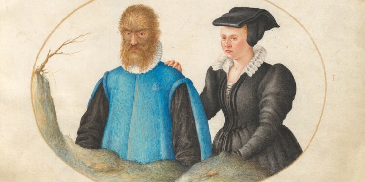 القصة الحقيقية لرائعة ديزني (الجميلة والوحش)