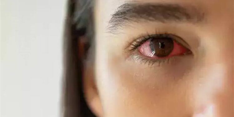 باكستان .. إغلاق 56 ألف مدرسة بسبب “عدوى فيروسية”