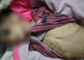 بغداد .. وفاة طفلة إثر تعرضها لتعنيف أُسري