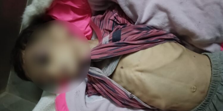 بغداد .. وفاة طفلة إثر تعرضها لتعنيف أُسري