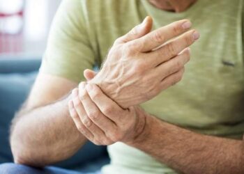 يد فوضوية و ذئب بشري … أمراض نادرة غريبة