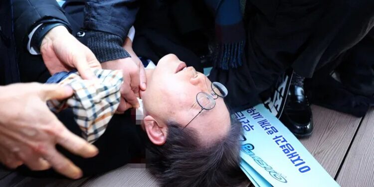 كوريا الجنوبية .. تعرض زعيم المعارضة الى طعن رقبته