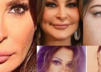 فنانات تشوهت وجوههن بسبب إدمانهن لعمليات التجميل