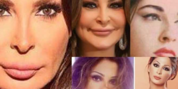 فنانات تشوهت وجوههن بسبب إدمانهن لعمليات التجميل