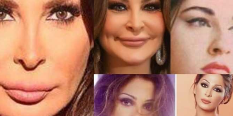 فنانات تشوهت وجوههن بسبب إدمانهن لعمليات التجميل