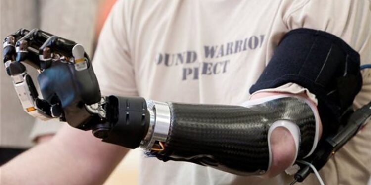 روسيا .. تطوير أطرافا صناعية للأطفال بمواصفات خاصة